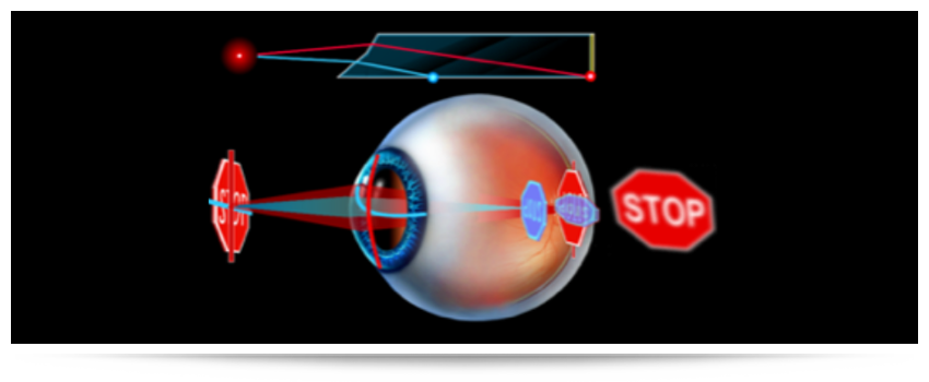 Astigmatism Lens Options